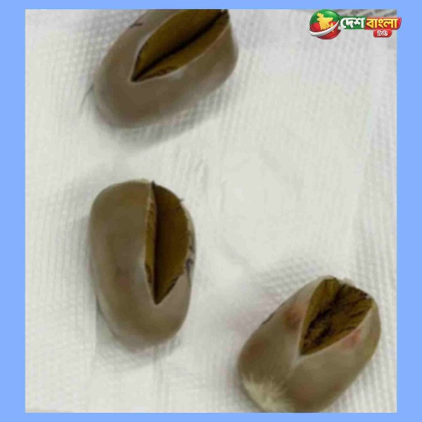 যাত্রীর শরীরে মিলল ১ কোটি ৭৪ লাখ টাকার সোনা, উদ্ধা...